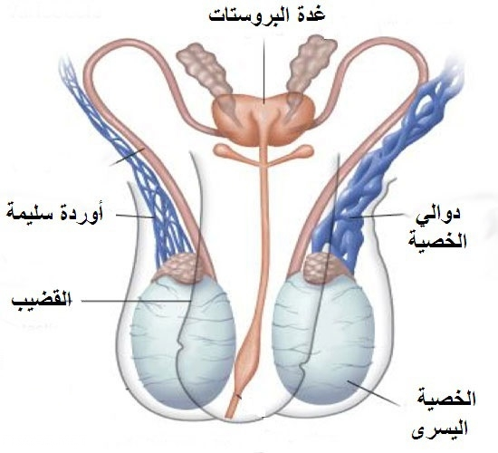 دوالي الخصية بالجهة اليسرى