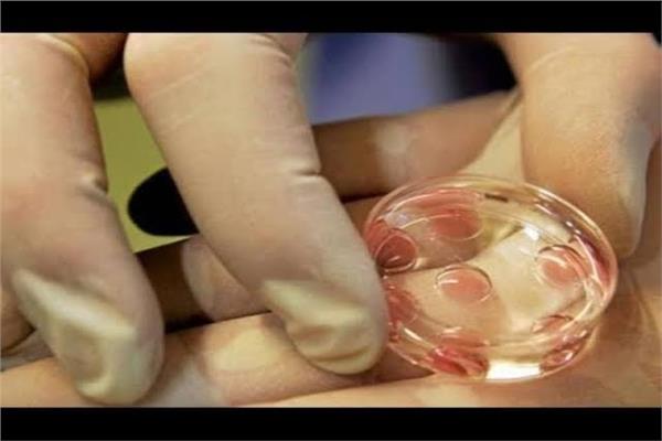 تجميد البويضات تخطى المرحلة التجريبية