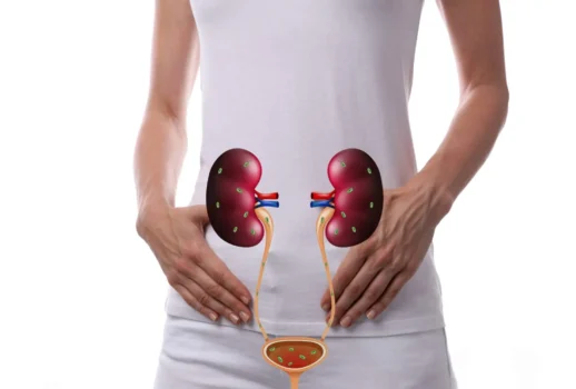 التهاب المسالك البولية.. 90% من الحالات تشفى دون مضاعفات!