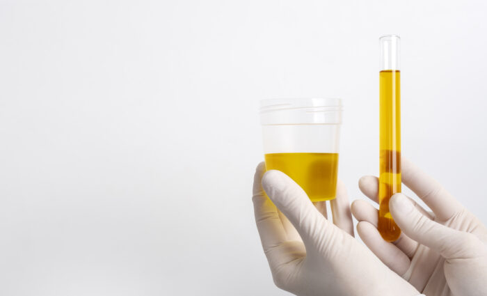 رائحة البول